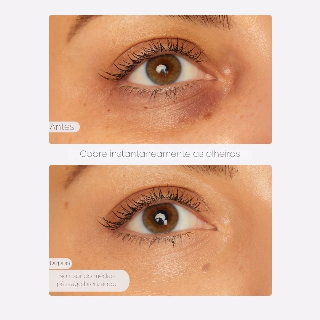 Corretivo Mágico ✨